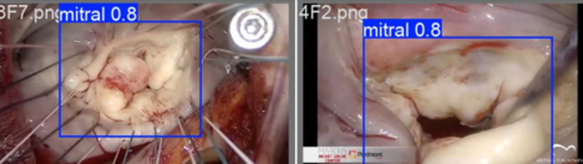 Medical Object Detection