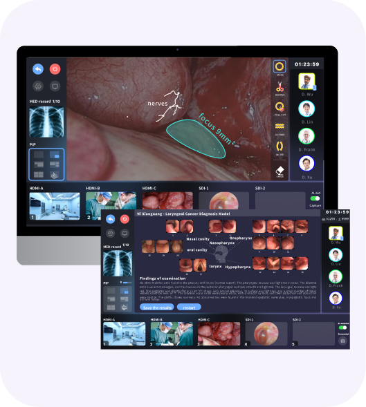 AI Surgical Assistance